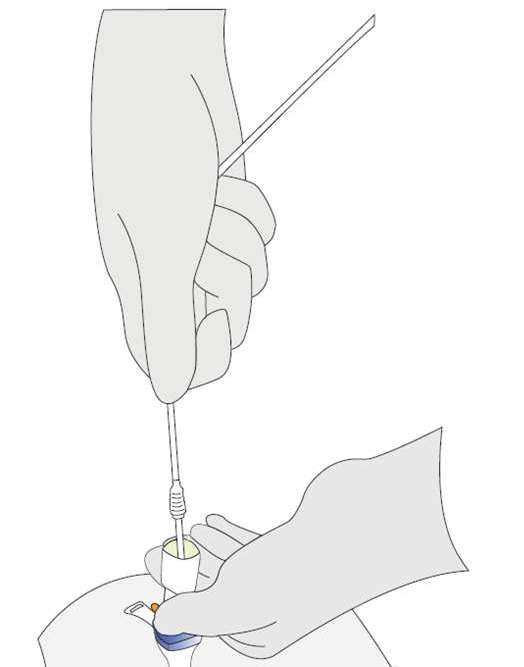 法国官方召回源每日巡检：INFORMATION AUX UTILISATEURS Dispositifs médicaux PUBLIÉ LE 05/10/2026 Canule de trachéotomie – Tracoe Vario Tracheostomy Tube/Experc Set Vario – Tracoe medical GmbH In
