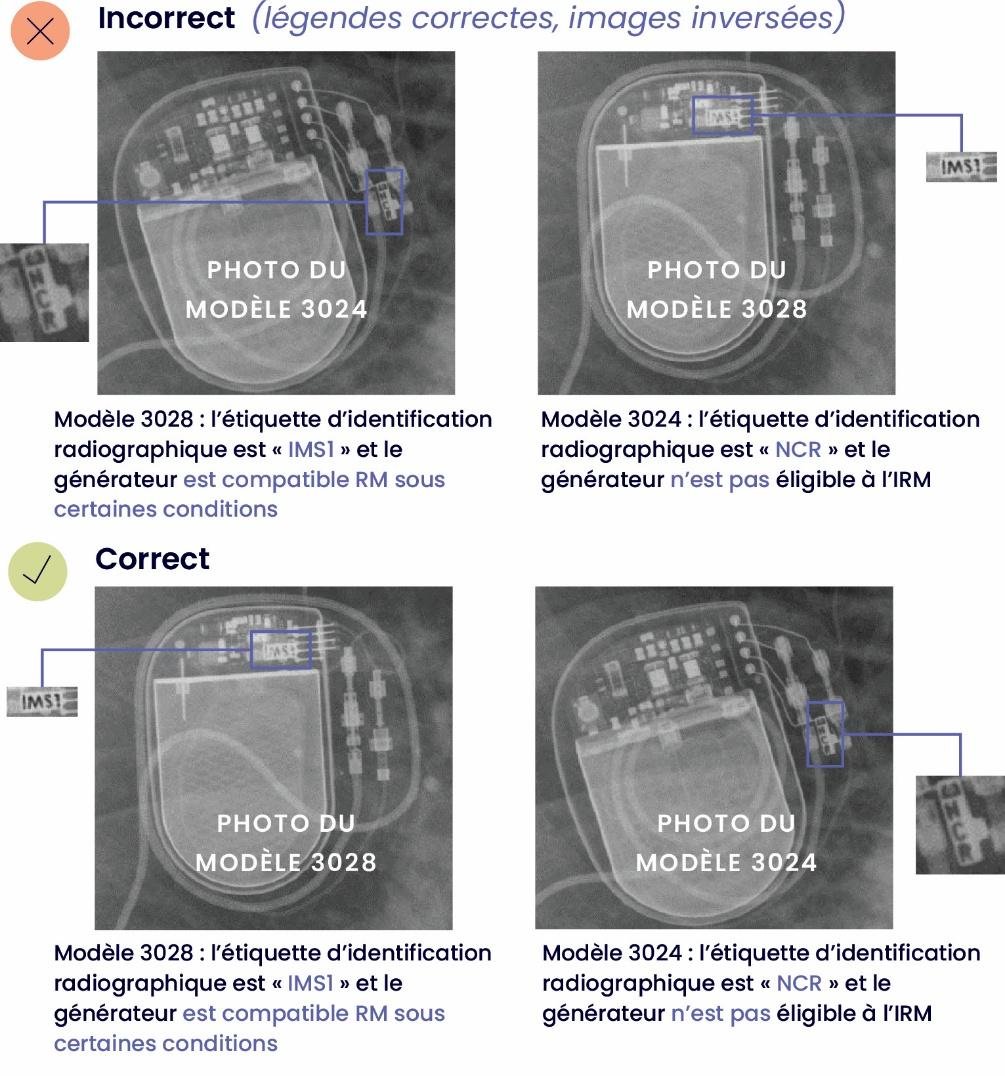 法国官方召回源每日巡检：INFORMATION AUX UTILISATEURS Dispositifs médicaux PUBLIÉ LE 08/10/2026 Neurostimulateur implantable – Générateur d’impulsions implantable (IPG) modèles 3024 et 3028 – I